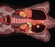 Interpretation of PET/CT findings in patients with advanced lung cancer ...