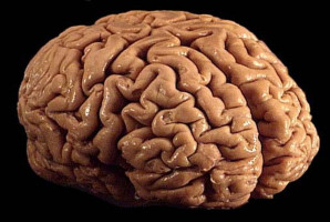 Un fármaco modifica el epigenoma de los tumores cerebrales agresivos