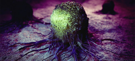 Newly discovered immune cell type may be key to improving pancreatic cancer immunotherapy