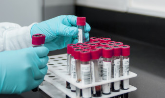 Cancer DNA blood tests validated by international research team