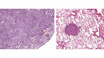 Structurally guided therapy shows promise for patients with specific EGFR-mutated lung cancer in Phase 1b trial