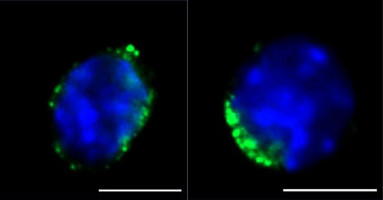 Aged bone marrow niche impedes function of rejuvenated haematopoietic stem cells