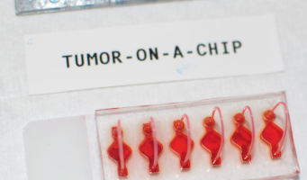 Personalised immunotherapy response studied in body-on-a-chip cancer models