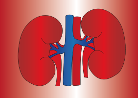 Patients with kidney disease may have an increased risk of cancer