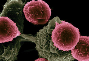 A ray of hope in the fight against cancer