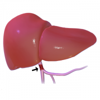 Portal vein thrombosis in patients with hepatocellular carcinoma
