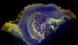Beyond the mammogram: Study finds differences between benign and cancerous breast calcifications