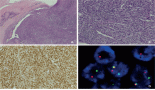 Exploring the enigma within: a retrospective study of primary cardiac sarcomas from a tertiary care centre