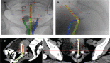 Radiation therapy for cervical cancer in Uganda: a practice guideline
