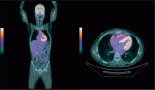An evidence-based approach to pericardial synovial sarcoma: a unique case report