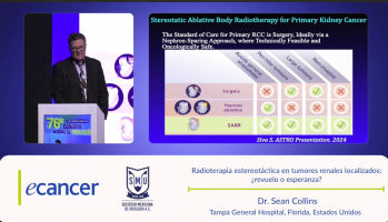Radioterapia estereotáctica en tumores renales localizados: ¿Revuelo o esperanza? ( Dr. Sean Collins - Tampa General Hospital, Florida, Estados Unidos )