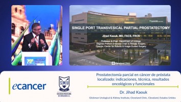 Prostatectomía parcial en cáncer de próstata localizado: indicaciones, técnica, resultados oncológicos y funcionales ( Dr. Jihad Kaouk - Glickman Urological & Kidney Institute, Cleveland Clinic Cleveland, Estados Unidos )