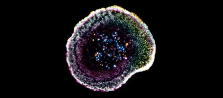 An unprecedented view of the immune system’s killer cells