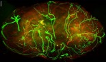 Nerves in skin can slow melanoma growth
