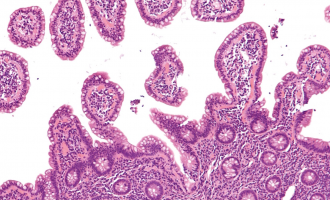 Researchers publish ‘playbook’ for understanding pancreatic cancer, one of the deadliest cancers