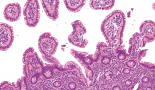 Researchers publish ‘playbook’ for understanding pancreatic cancer, one of the deadliest cancers
