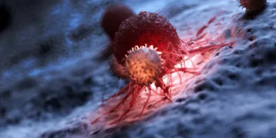 La terapia combinada con células inmunitarias derivadas de células madre potencia la respuesta contra el cáncer