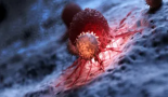 La terapia combinada con células inmunitarias derivadas de células madre potencia la respuesta contra el cáncer