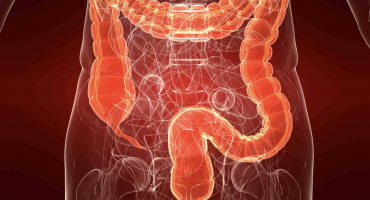 Single screening sigmoidoscopy linked to lower colorectal cancer risk two decades later