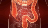 Single screening sigmoidoscopy linked to lower colorectal cancer risk two decades later