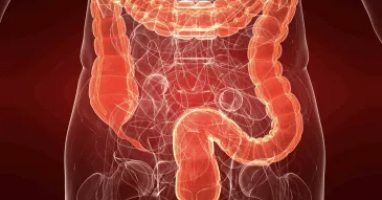 Una única sigmoidoscopia de cribado se asocia a un menor riesgo de cáncer colorrectal dos décadas después