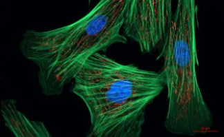 Los «ganchos moleculares» mejoran la precisión y la eficacia de los fármacos contra el cáncer