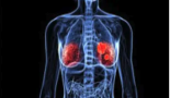 El tejido adiposo podría explicar la diseminación del cáncer de mama triple negativo y apuntar hacia posibles tratamientos