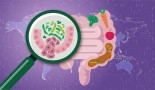 Large-scale microbiome study identifies robust colorectal cancer signature