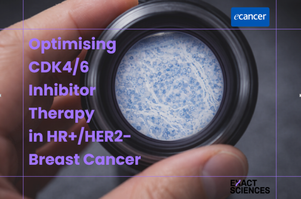 Optimising CDK4/6 Inhibitor Therapy  in HR+/HER2− Breast Cancer