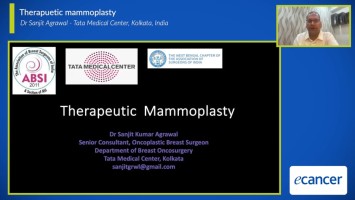 Therapeutic mammoplasty: An advanced oncoplastic breast surgery technique ( Dr Sanjit Agrawal - Tata Medical Center, Kolkata, India )
