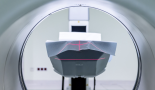 WCLC 2026: Trial supports brain MRI surveillance alone as standard of care for small-cell lung cancer